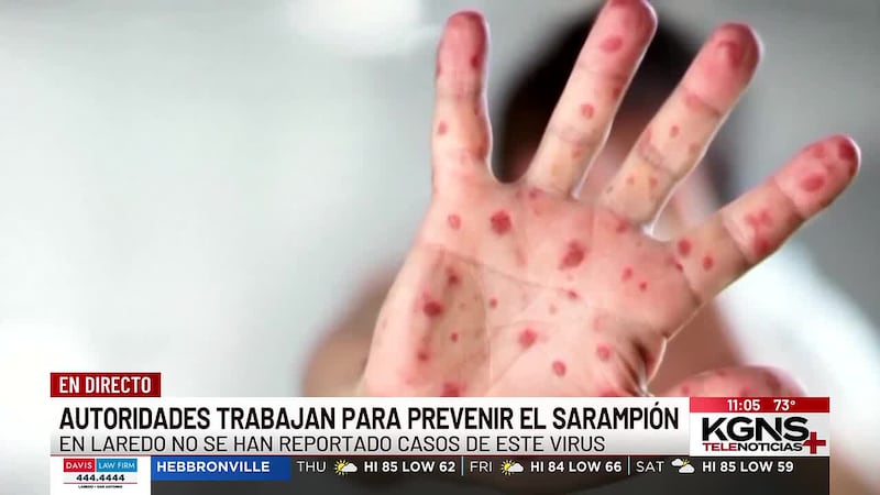 Autoridades de Laredo trabajan para prevenir el sarampión