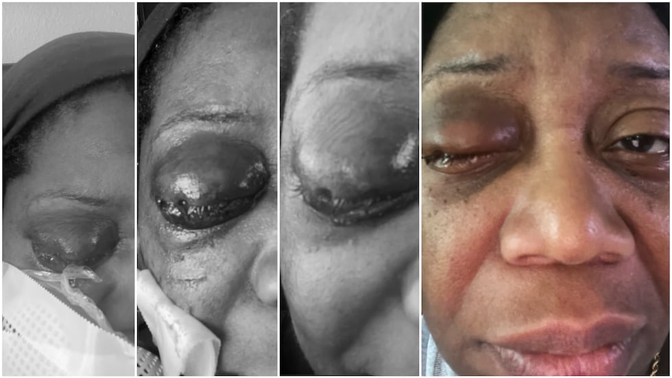 Candra Rogers' injury