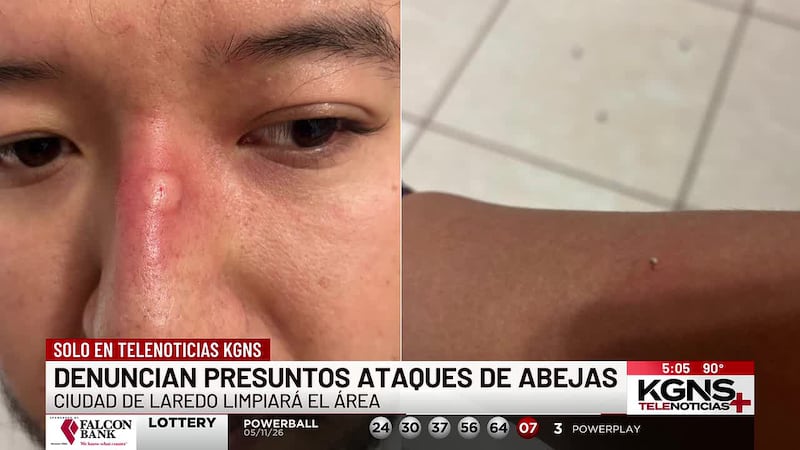 Familia de Laredo denuncia presuntos ataques de abejas
