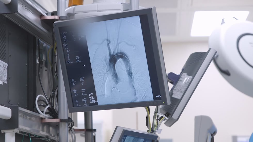 New blood tests could pinpoint heart & stroke risk