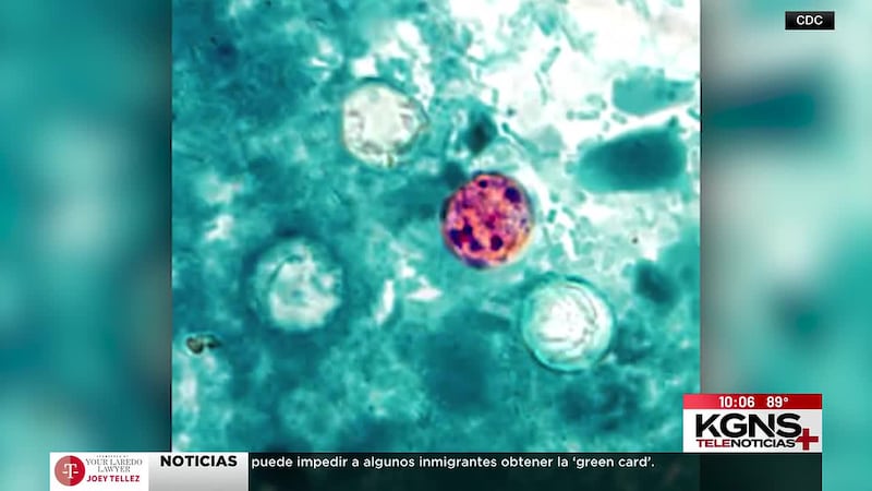 Confirman 7 casos de ciclosporiasis en Laredo