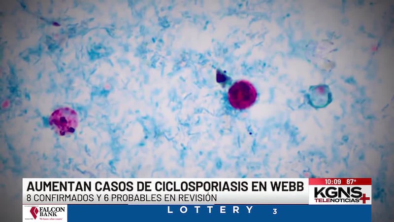 Aumentan casos de ciclosporiasis en Condado de Webb